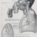 Hand Bulb Nebulizer