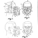 1948 Bennett's "Respiratory Facial Mask"