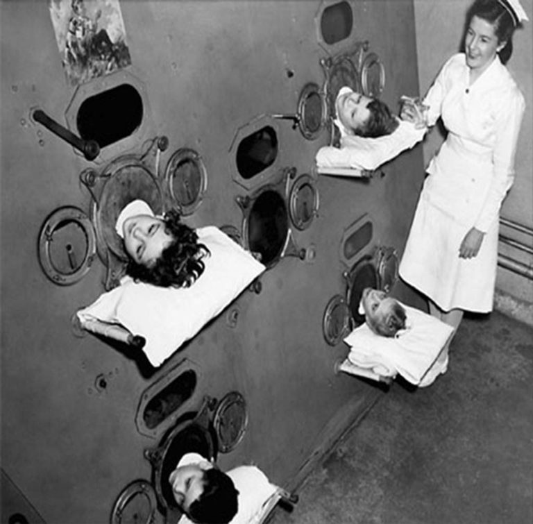 1950s Multi-Person Ventilator